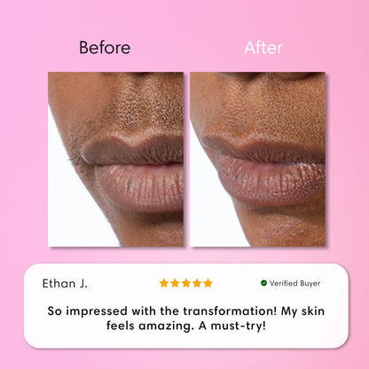 Instant Hair Removal Kit