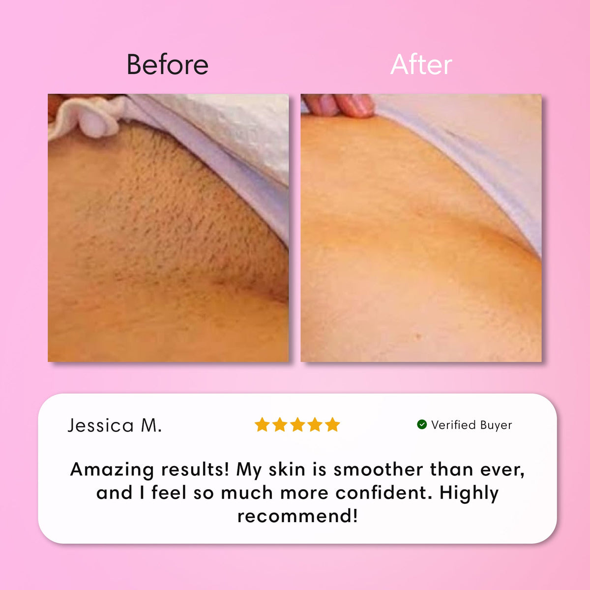 Painless Body Hair Removal Cream