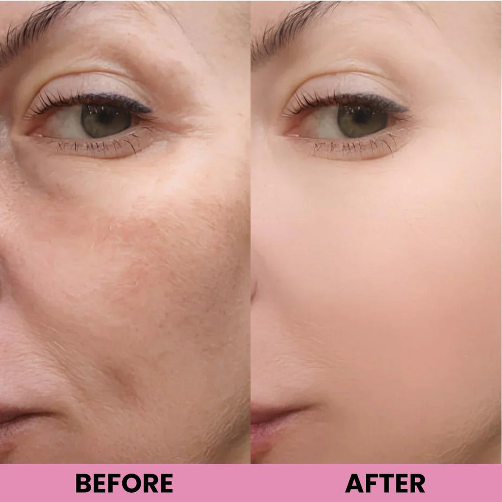 Peel Shot Glow Rice Ampoule Duo by Aurlux